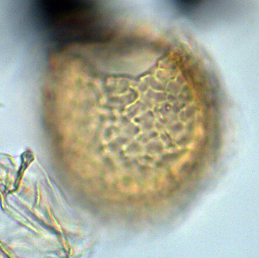 (Cassidium fragile), U1581-21R-4W, 114-119, sl. 2, N18, foto-e.jpg